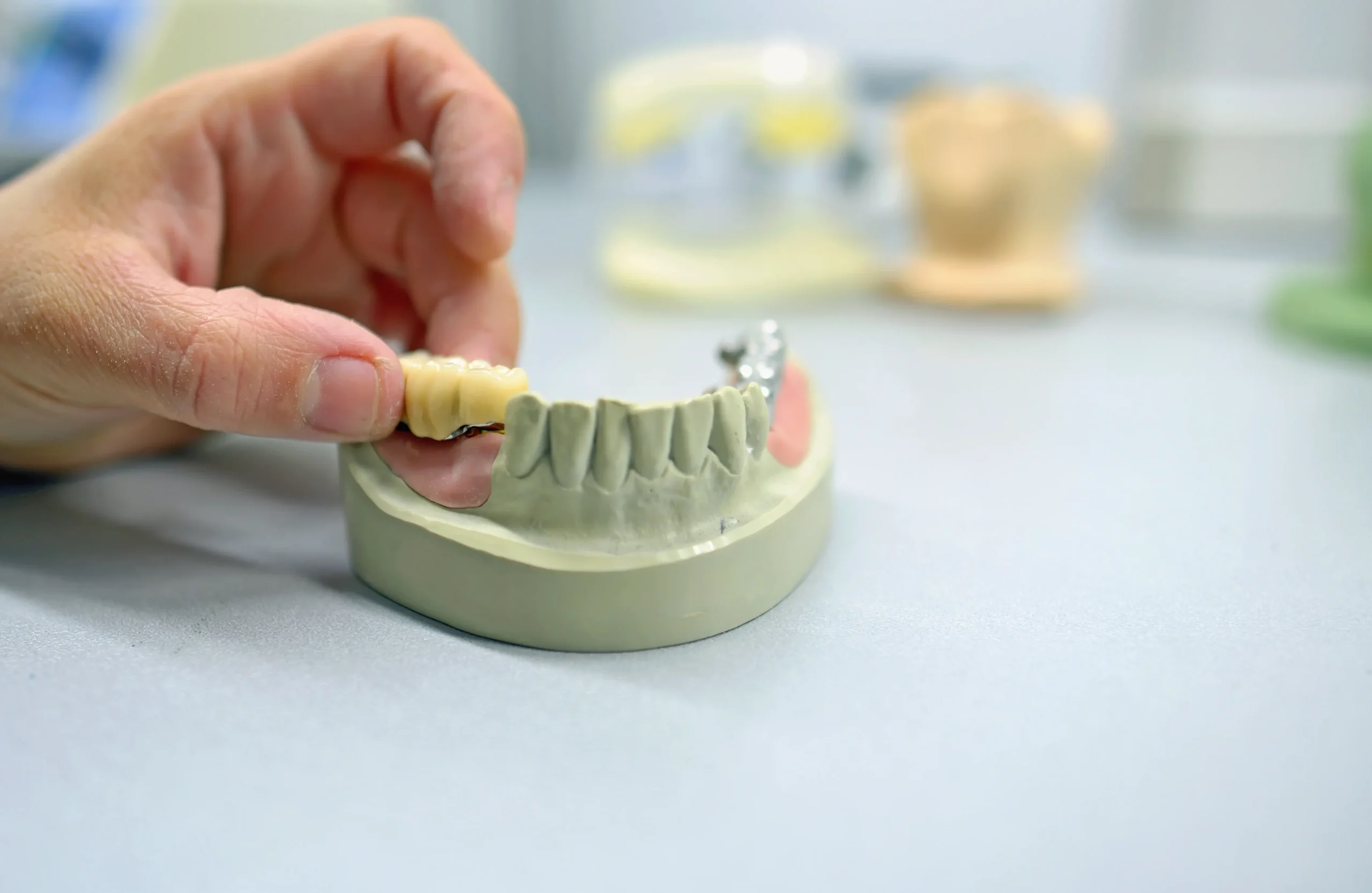 Partial Dentures